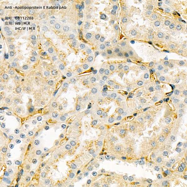 Антитела первичные, поликлональные, Apolipoprotein E, 100 мкл