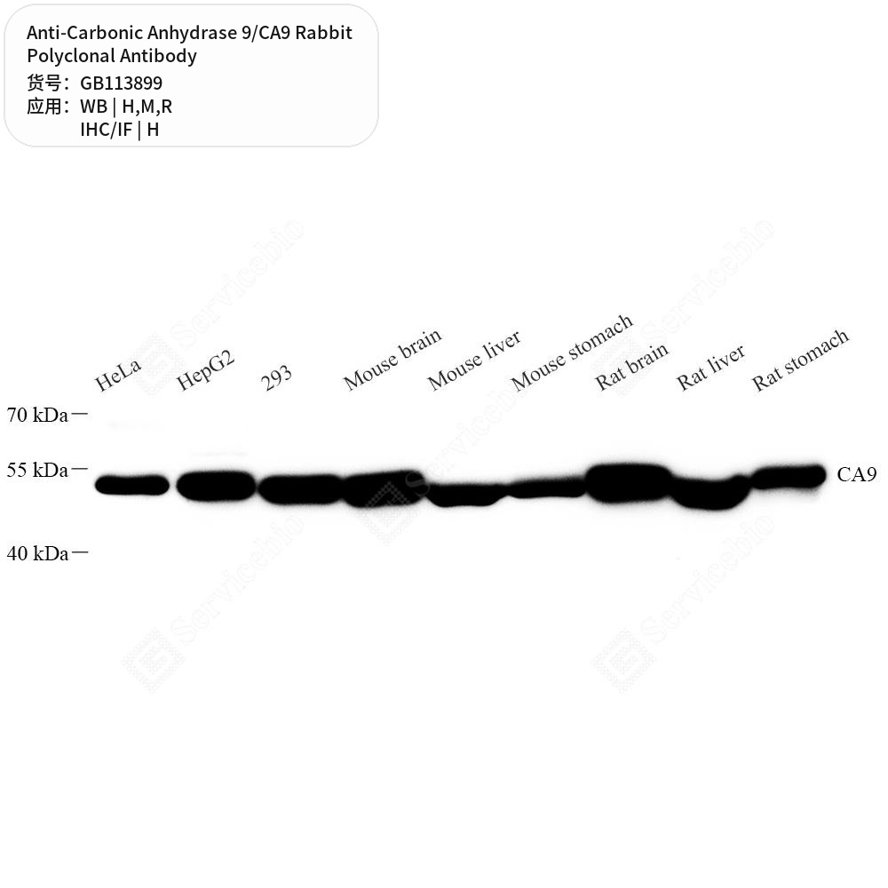 Антитела первичные, поликлональные кролика к Carbonic Anhydrase 9/CA9 крысы, мыши, человека, 50 мкл