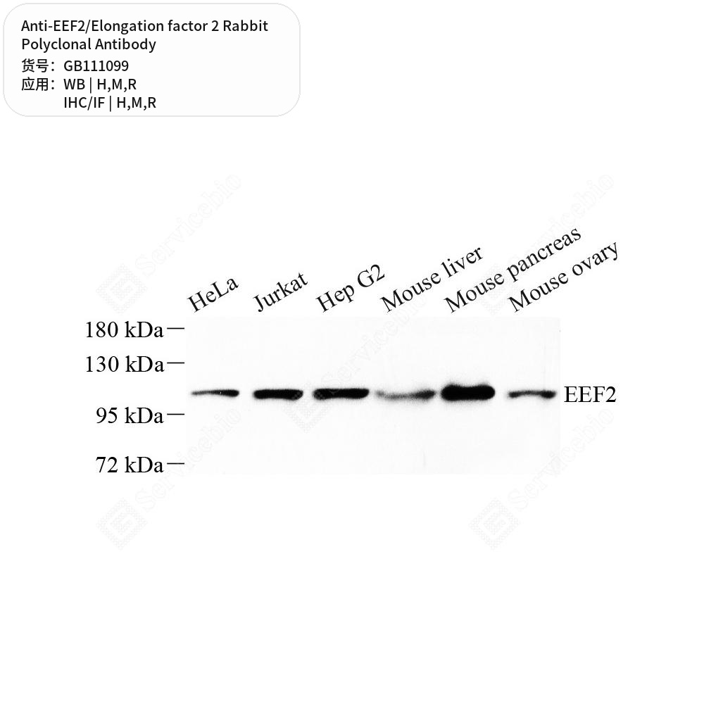 Антитела первичные, поликл. кролика к EEF2/Elongation factor 2 крысы, мыши, человека, 100 мкл