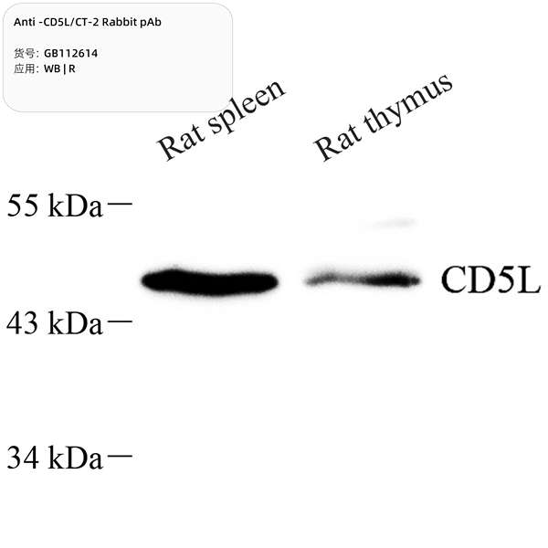 Антитела первичные, поликлональные, CD5L/CT-2, 100 мкл