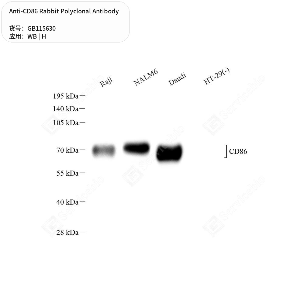Антитела первичные, поликлональные кролика к CD86 человека, 50 мкл