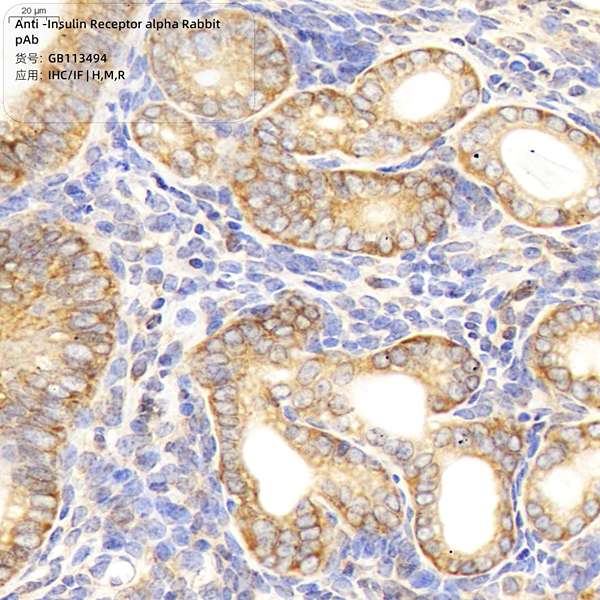 Антитела первичные, поликлональные, Insulin Receptor alpha, 100 мкл