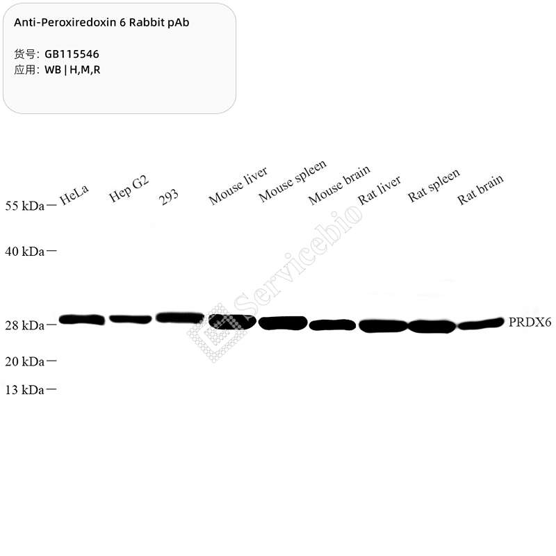 Антитела первичные, поликлональные, Peroxiredoxin 6, 100 мкл