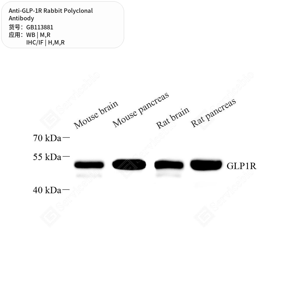 Антитела первичные, поликлональные кролика к GLP-1R крысы, мыши, человека, 50 мкл