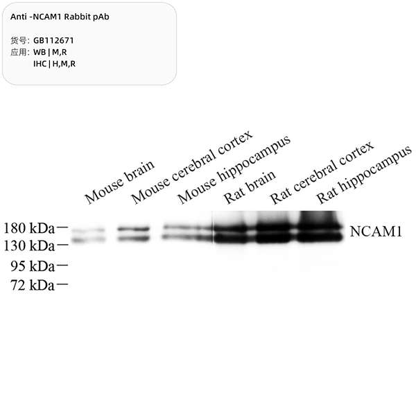 Антитела первичные, поликлональные, NCAM1, 100 мкл