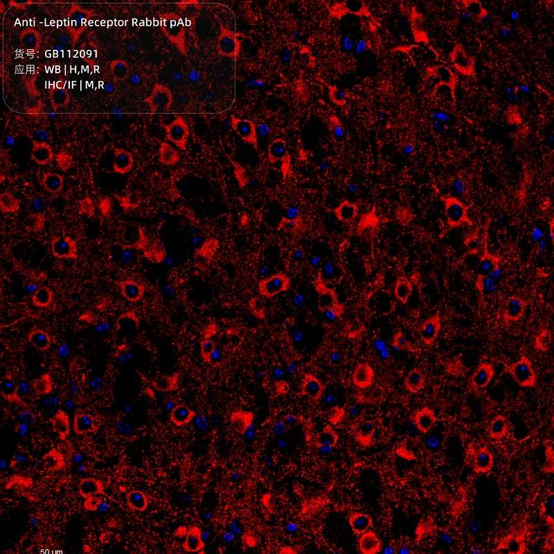 Антитела первичные, поликлональные, Leptin Receptor, 100 мкл