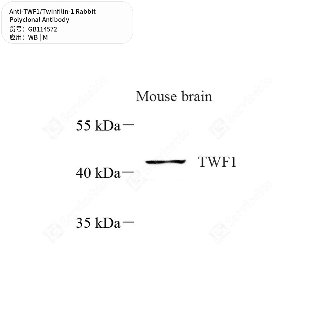 Антитела первичные, поликлональные кролика к TWF1/Twinfilin-1 мыши, 100 мкл