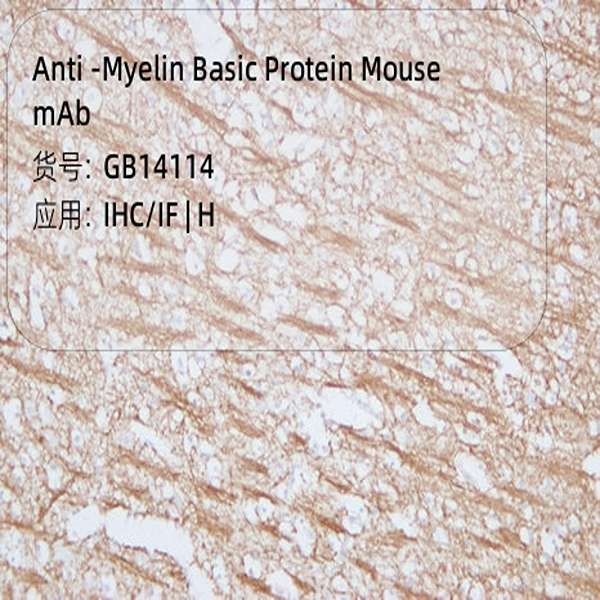 Антитела первичные, моноклональные, Myelin Basic Protein, 50 мкл