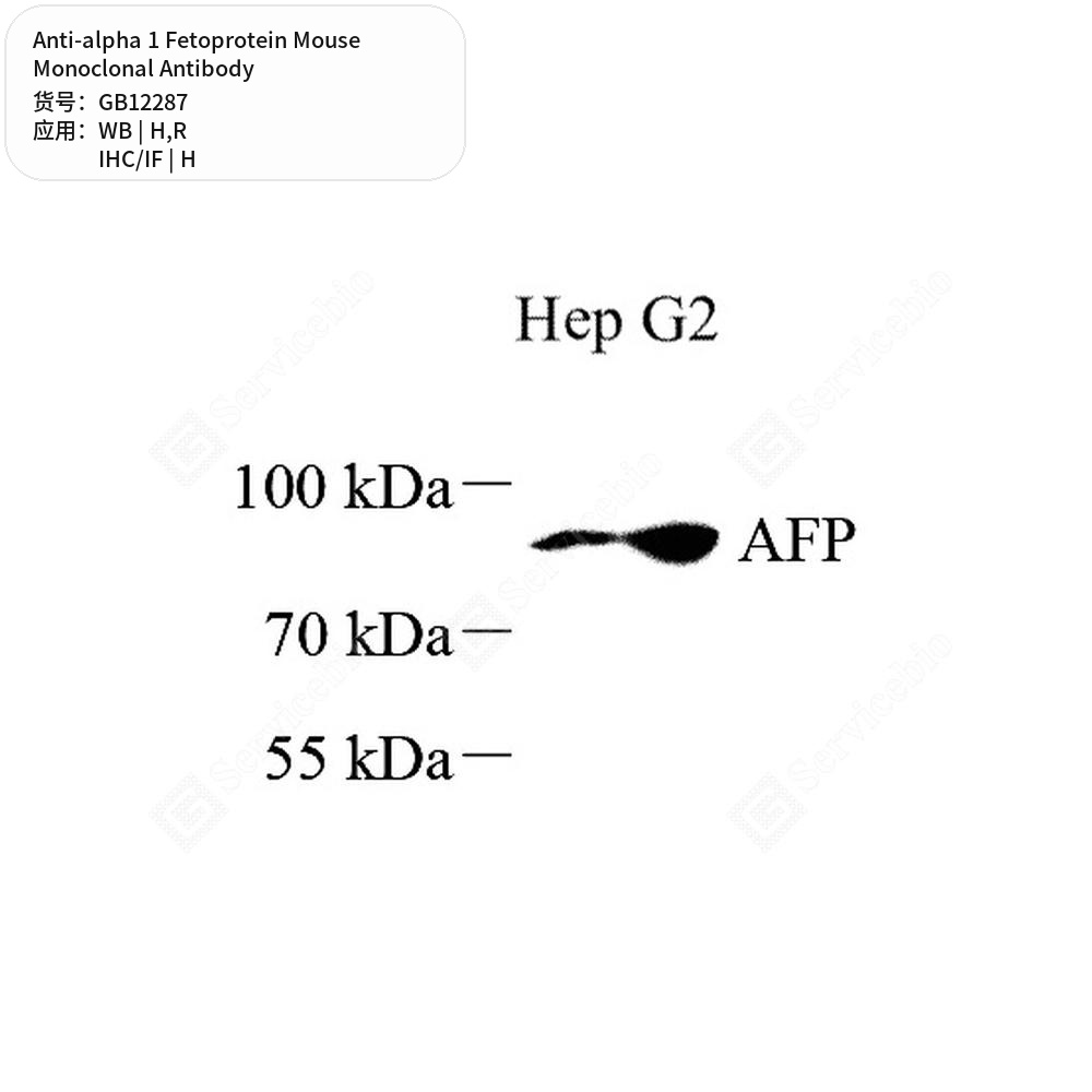 Антитела первичные, моноклональные мыши к alpha 1 Fetoprotein крысы, человека, 50 мкл