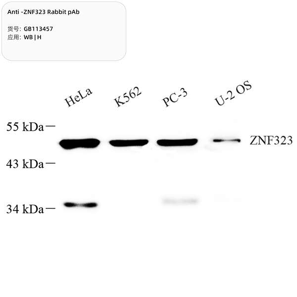 Антитела первичные, поликлональные, ZNF323, 100 мкл