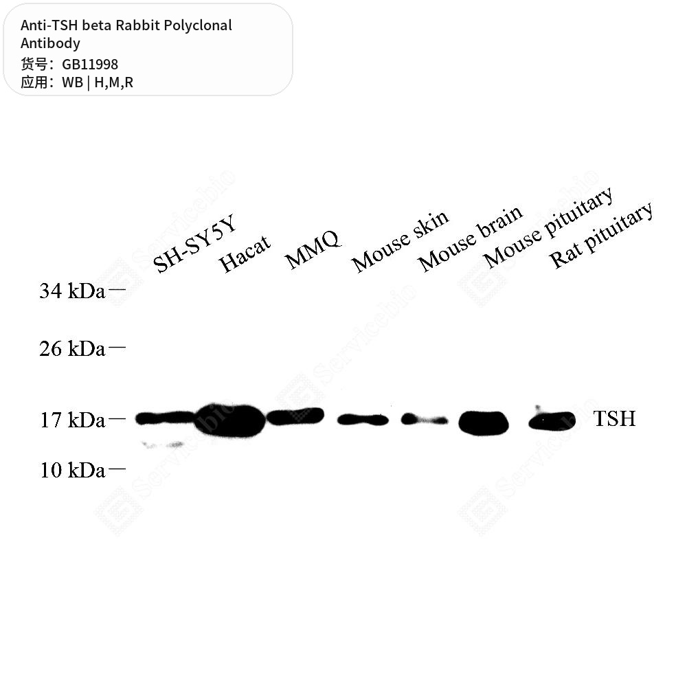 Антитела первичные, поликлональные кролика к TSH beta крысы, мыши, человека, 50 мкл