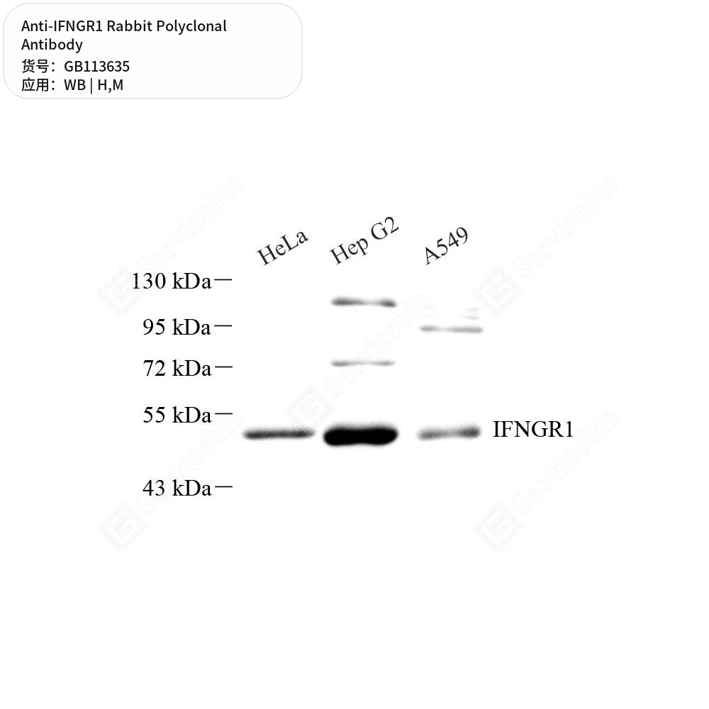Антитела первичные, поликлональные кролика к IFNGR1 мыши, человека, 100 мкл
