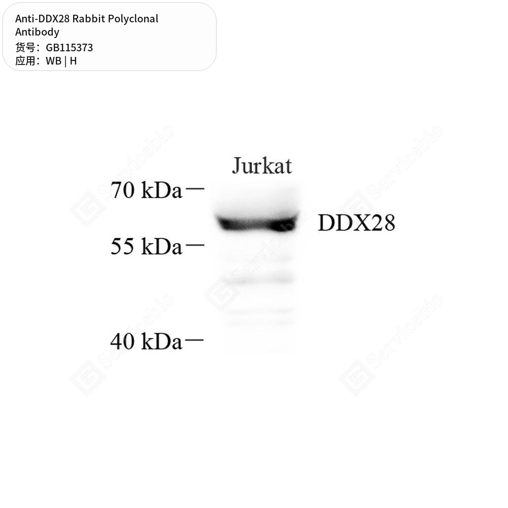 Антитела первичные, поликлональные кролика к DDX28 человека, 50 мкл