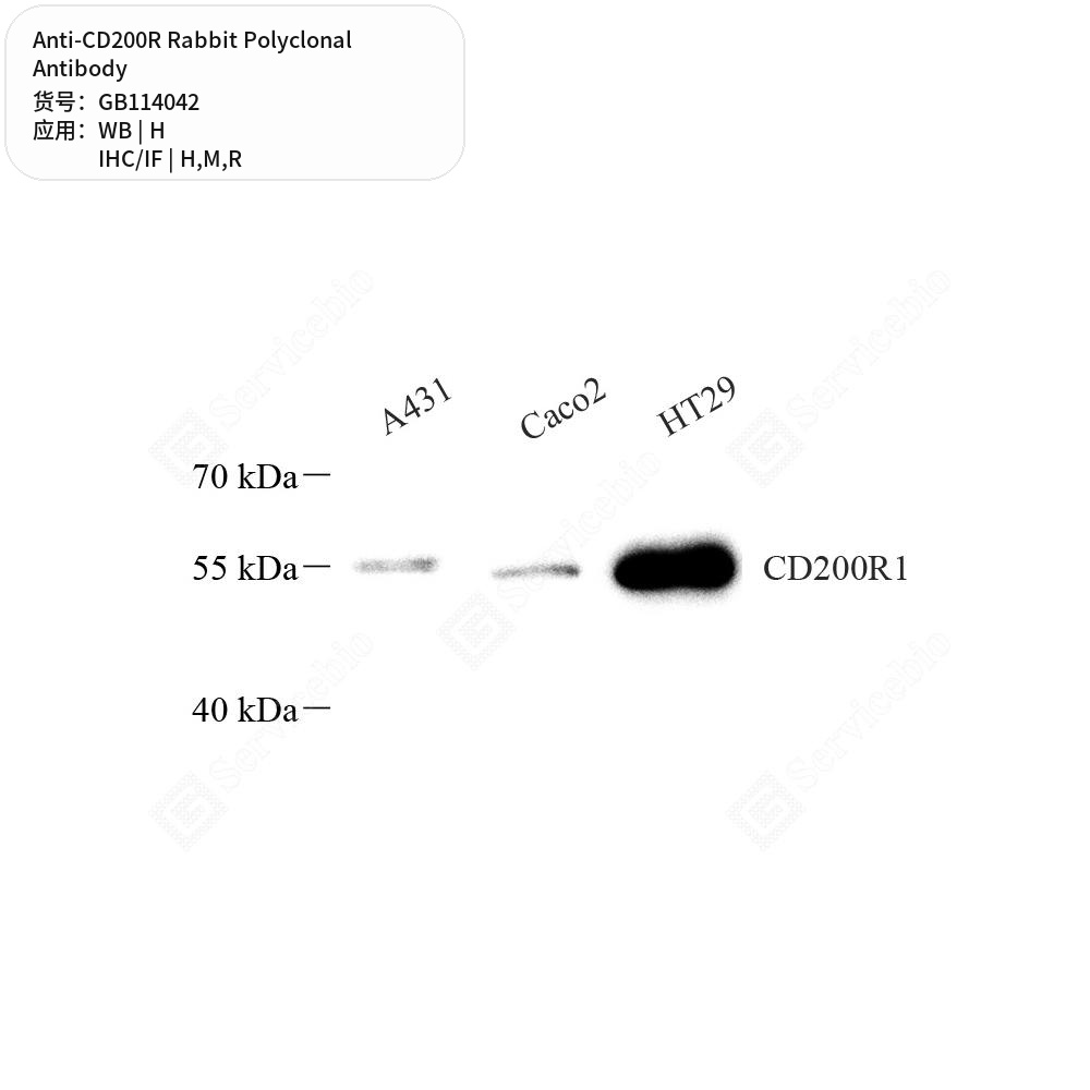 Антитела первичные, поликлональные кролика к CD200R крысы, мыши, человека, 100 мкл
