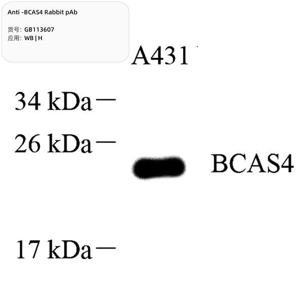 Антитела первичные, поликлональные, BCAS4, 100 мкл