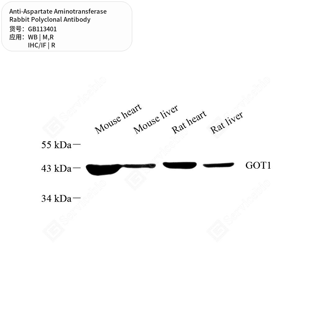 Антитела первичные, поликлональные кролика к Aspartate Aminotransferase крысы, мыши, 50 мкл
