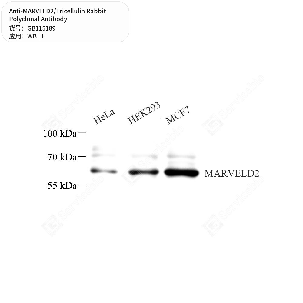 Антитела первичные, поликлональные кролика к MARVELD2/Tricellulin человека, 50 мкл