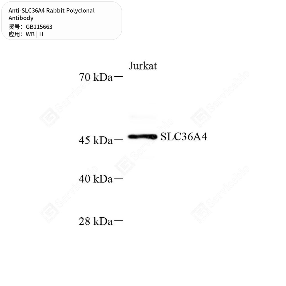 Антитела первичные, поликлональные кролика к SLC36A4 человека, 50 мкл