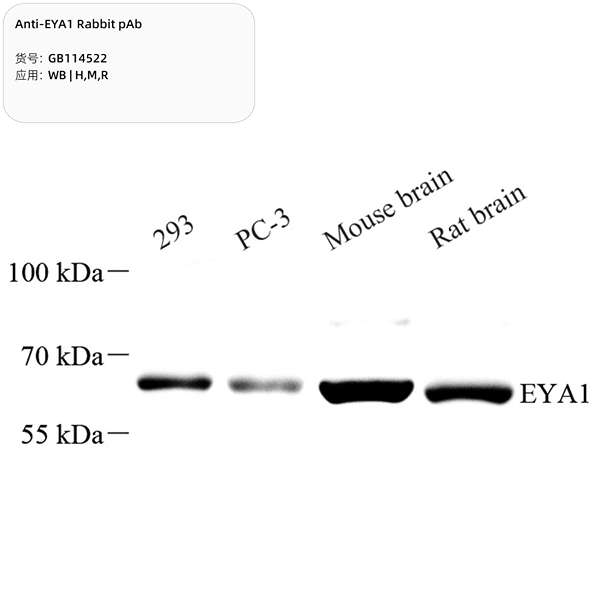 Антитела первичные, поликлональные, EYA1, 100 мкл