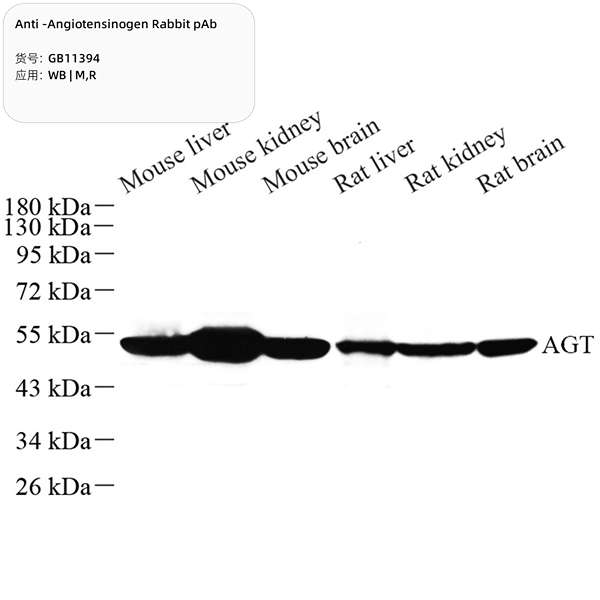 Антитела первичные, поликлональные, Angiotensinogen, 100 мкл