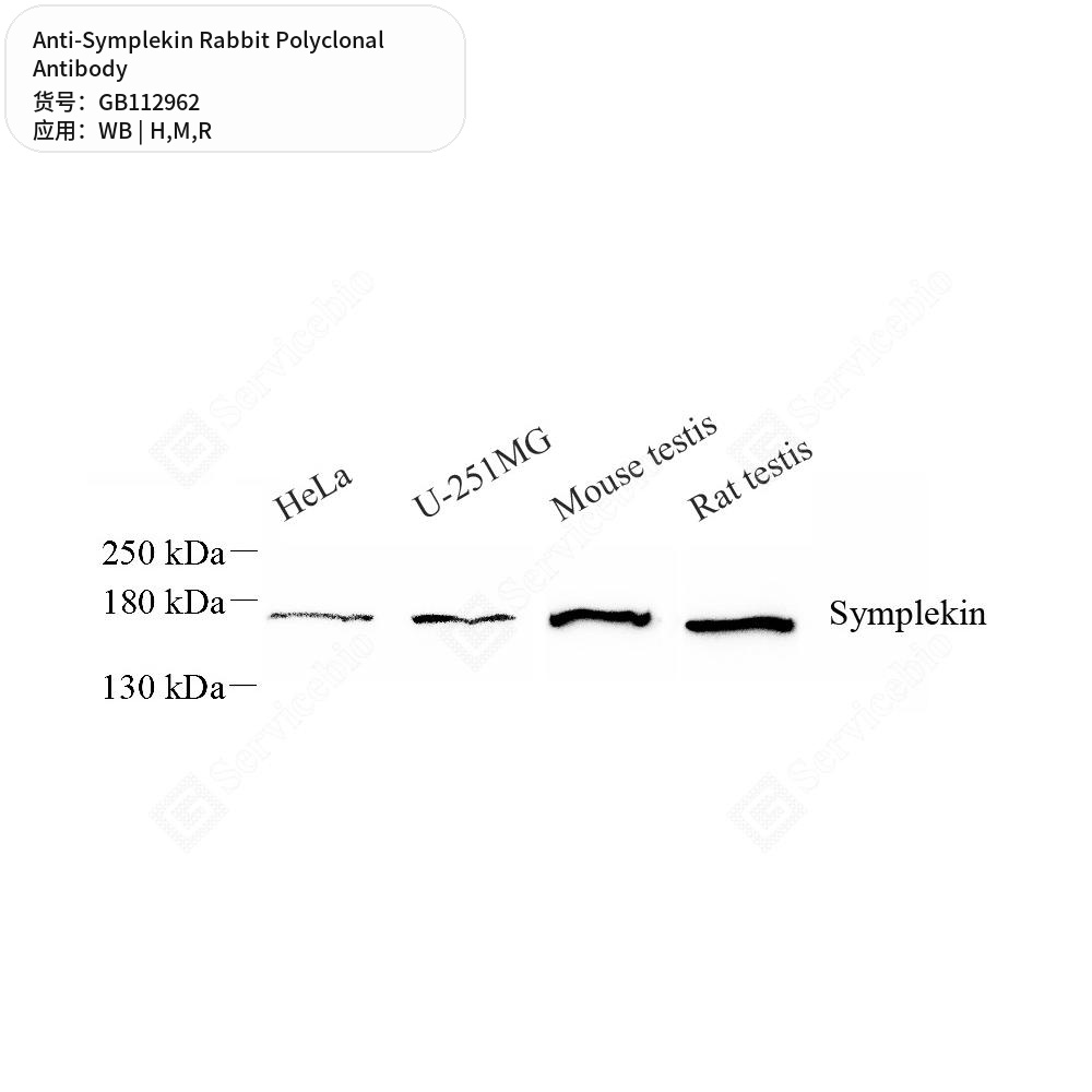 Антитела первичные, поликлональные кролика к Symplekin крысы, мыши, человека, 100 мкл
