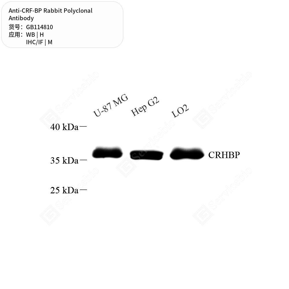 Антитела первичные, поликлональные кролика к CRF-BP мыши, человека, 50 мкл