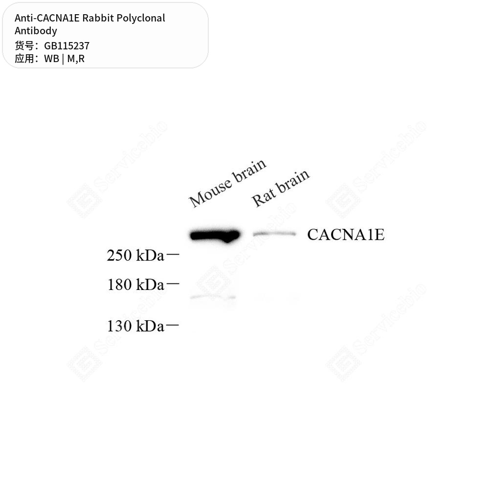 Антитела первичные, поликлональные кролика к CACNA1E крысы, мыши, 100 мкл