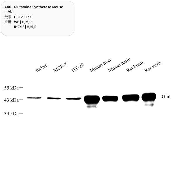Антитела первичные, моноклональные, Glutamine Synthetase, 100 мкл