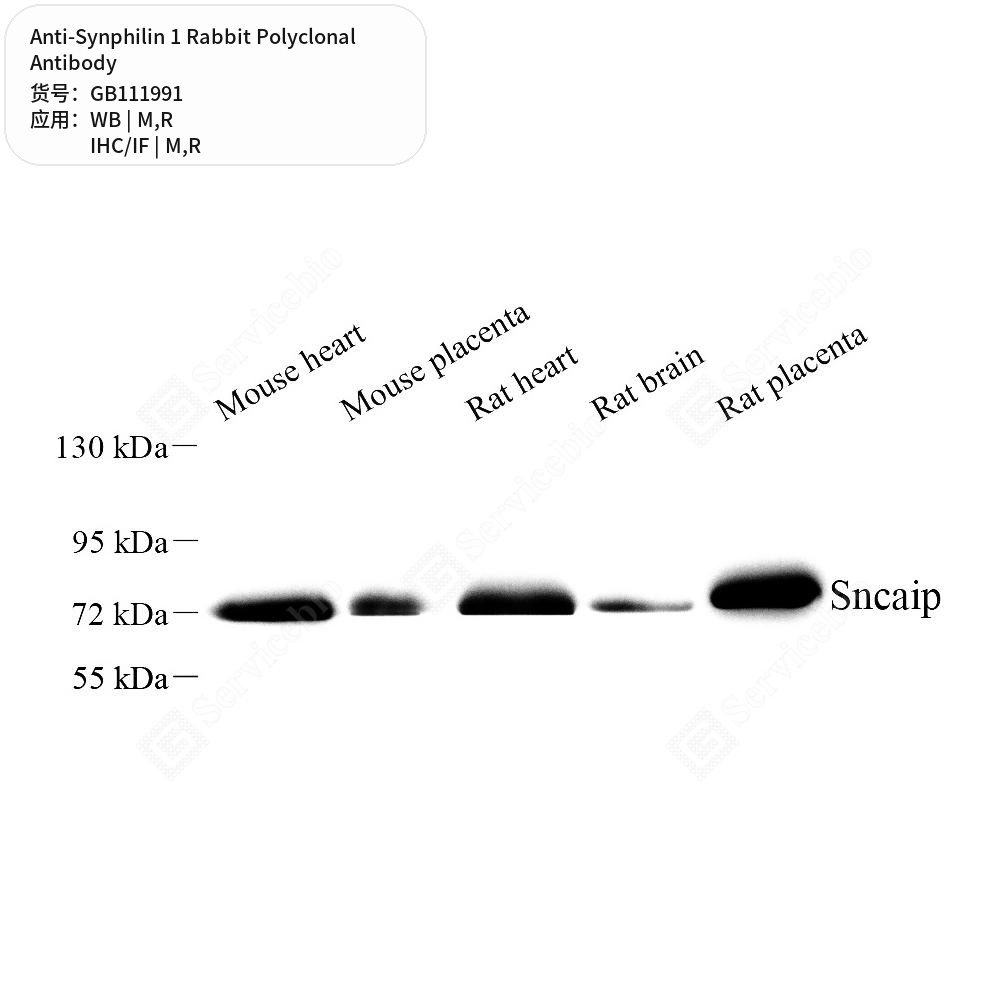 Антитела первичные, поликлональные кролика к Synphilin 1 крысы, мыши, 100 мкл