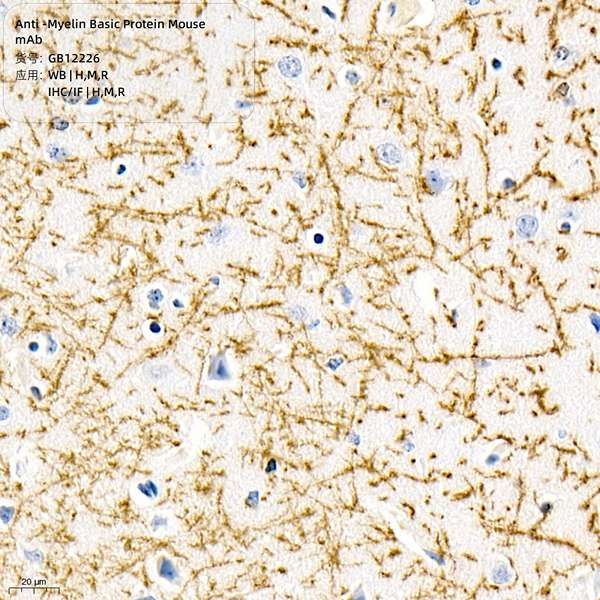 Антитела первичные, моноклональные, Myelin Basic Protein, 100 мкл