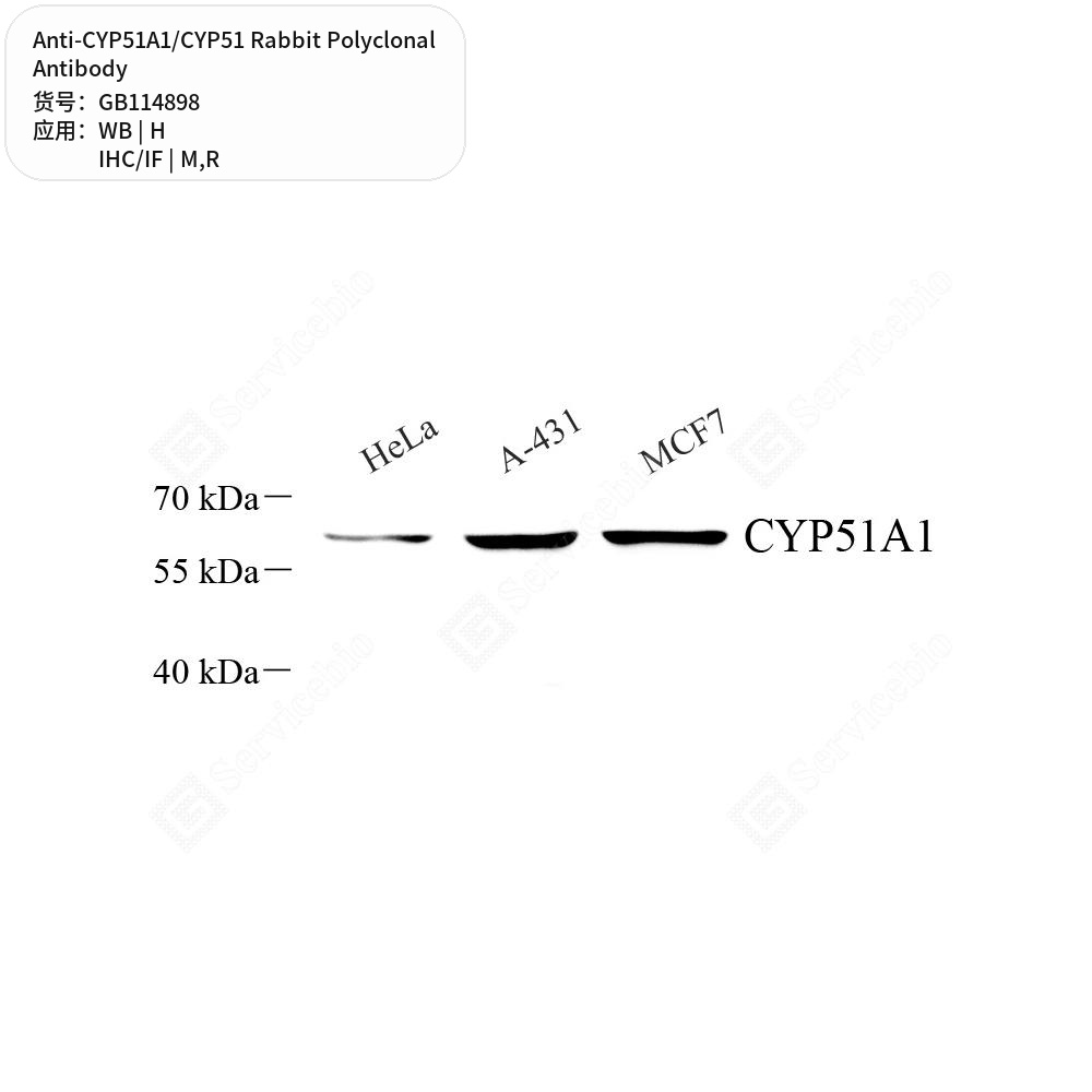 Антитела первичные, поликлональные кролика к CYP51A1/CYP51 крысы, мыши, человека, 50 мкл