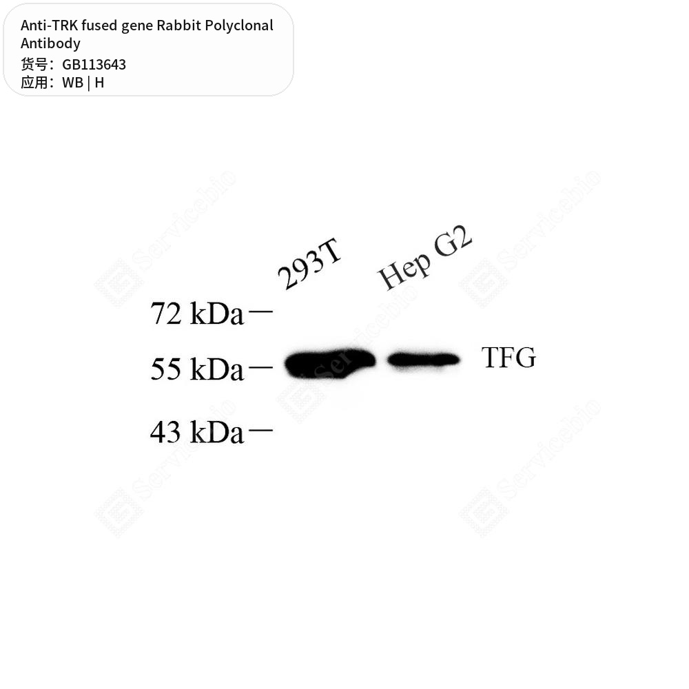Антитела первичные, поликлональные кролика к TRK fused gene человека, 100 мкл