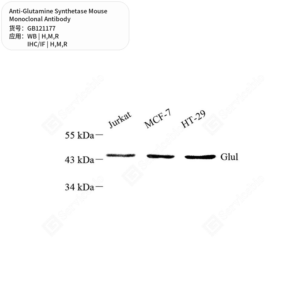 Антитела первичные, моноклональные мыши к Glutamine Synthetase крысы, мыши, человека, 50 мкл