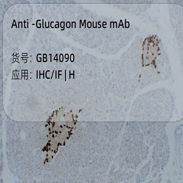 Антитела первичные, моноклональные, Glucagon, 50 мкл