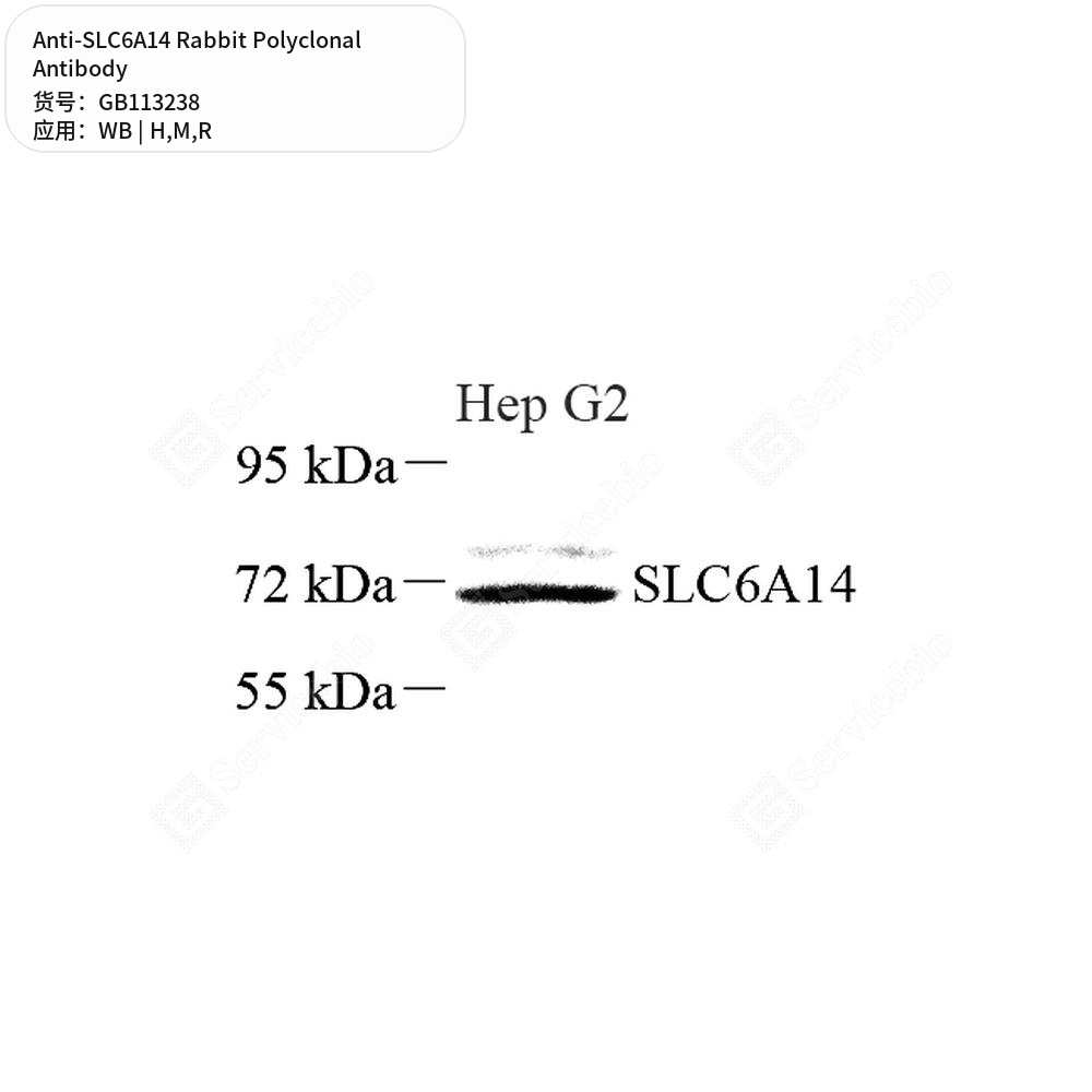Антитела первичные, поликлональные кролика к SLC6A14 крысы, мыши, человека, 100 мкл