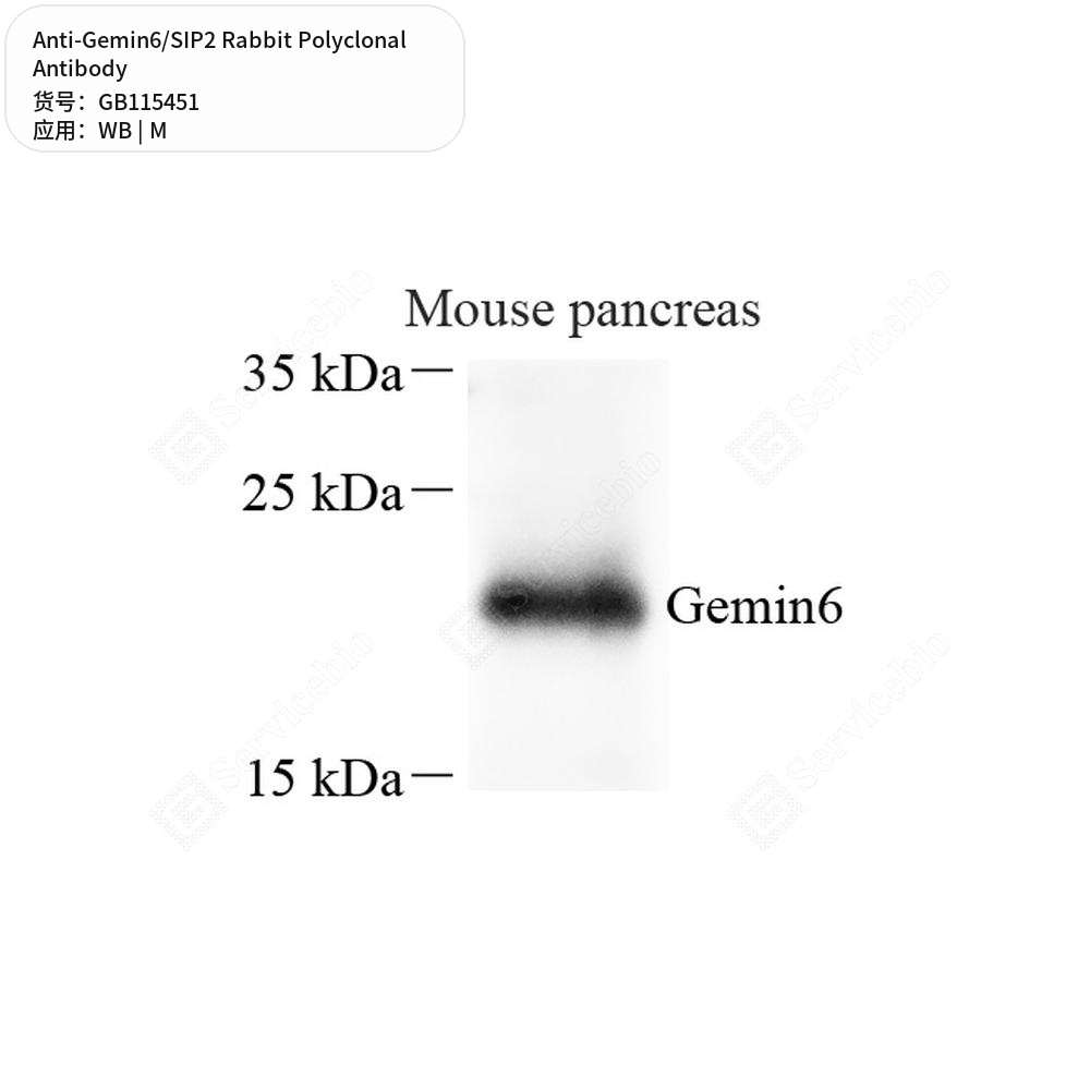 Антитела первичные, поликлональные кролика к Gemin6/SIP2 мыши, 100 мкл