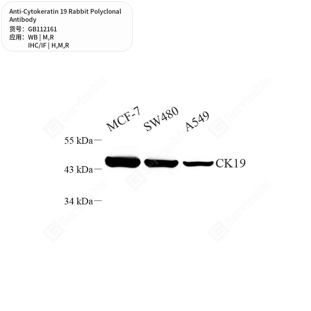 Антитела первичные, поликлональные кролика к Cytokeratin 19 крысы, мыши, человека, 100 мкл