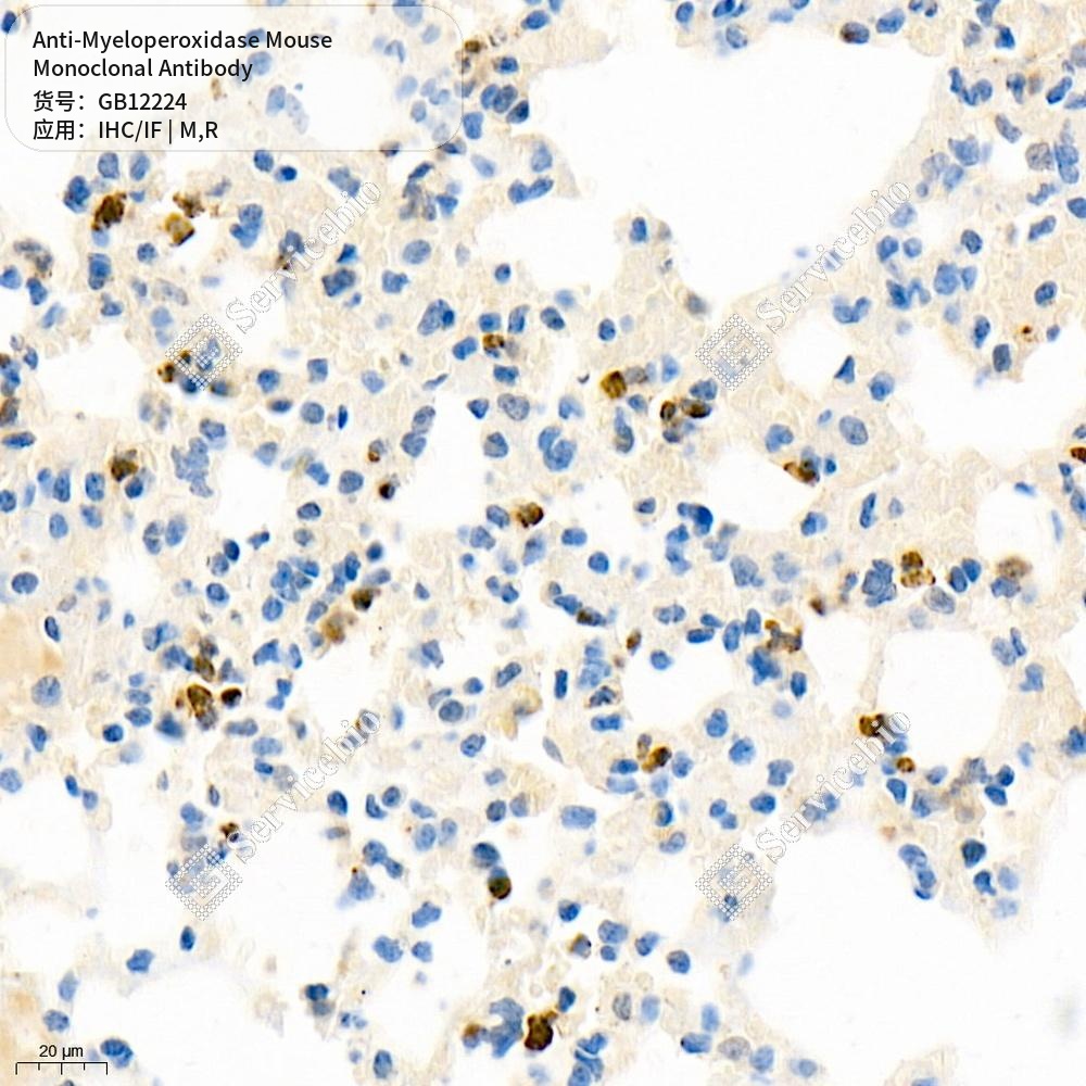 Антитела первичные, моноклональные мыши к Myeloperoxidase крысы, мыши, 50 мкл