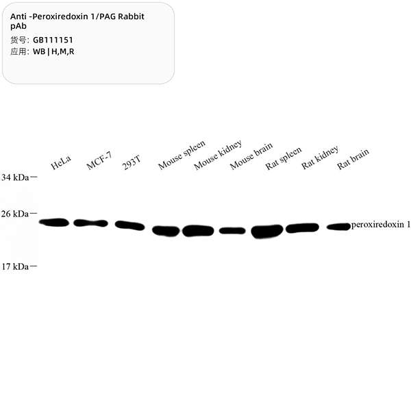 Антитела первичные, поликлональные, Peroxiredoxin 1/PAG, 100 мкл