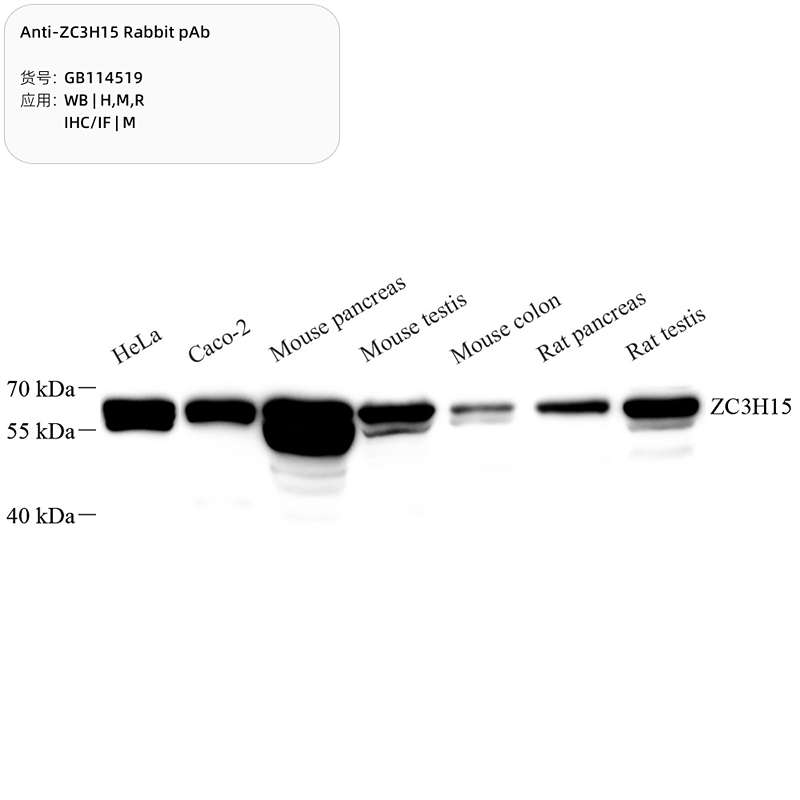 Антитела первичные, поликлональные, ZC3H15, 100 мкл