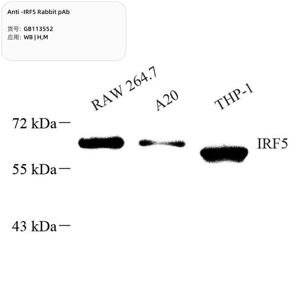 Антитела первичные, поликлональные, IRF5, 100 мкл
