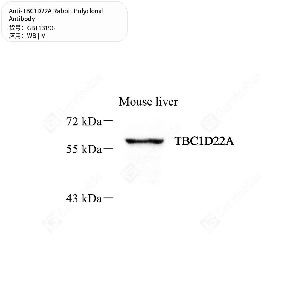 Антитела первичные, поликлональные кролика к TBC1D22A мыши, 50 мкл
