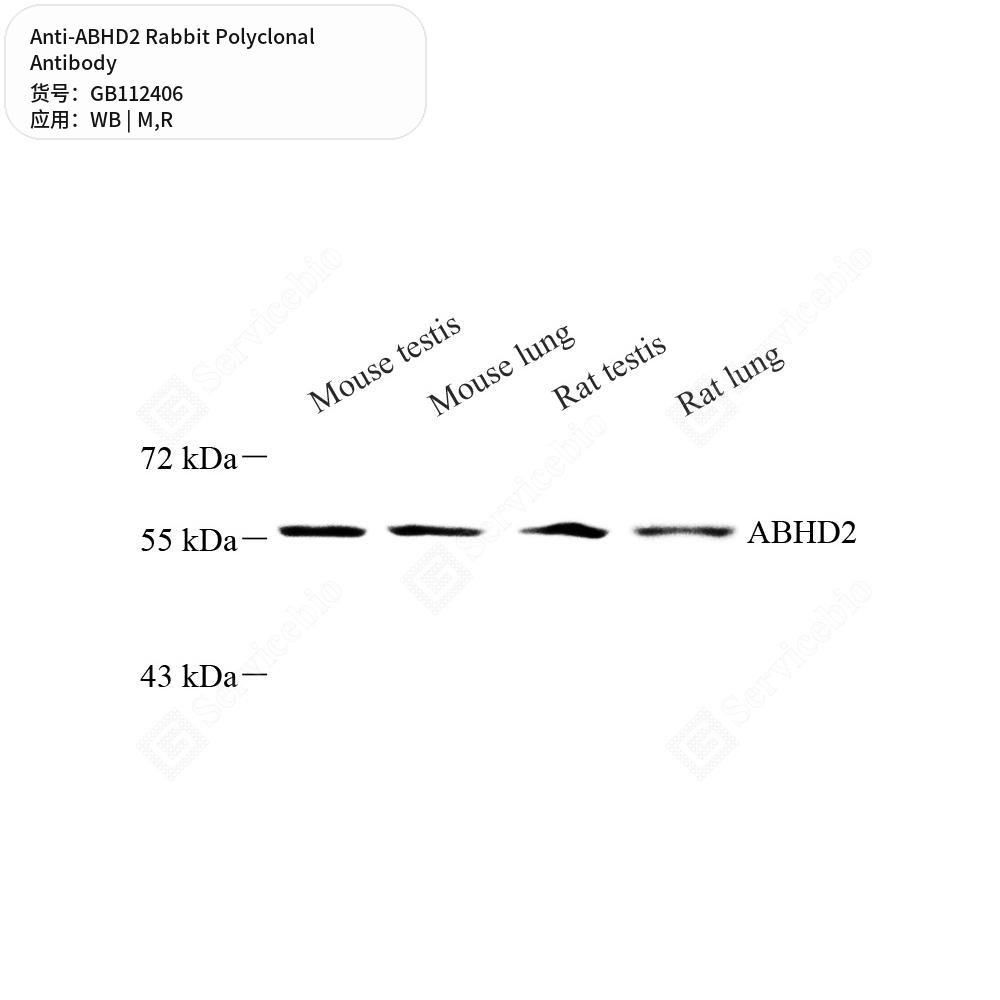 Антитела первичные, поликлональные кролика к ABHD2 крысы, мыши, 100 мкл