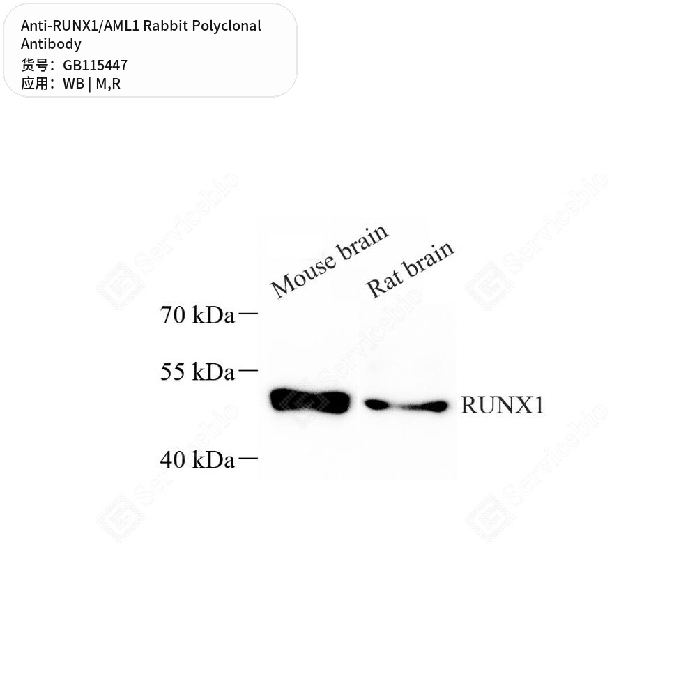 Антитела первичные, поликлональные кролика к RUNX1/AML1 крысы, мыши, 100 мкл