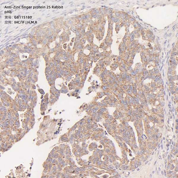 Антитела первичные, поликлональные, Zinc finger protein 25, 100 мкл