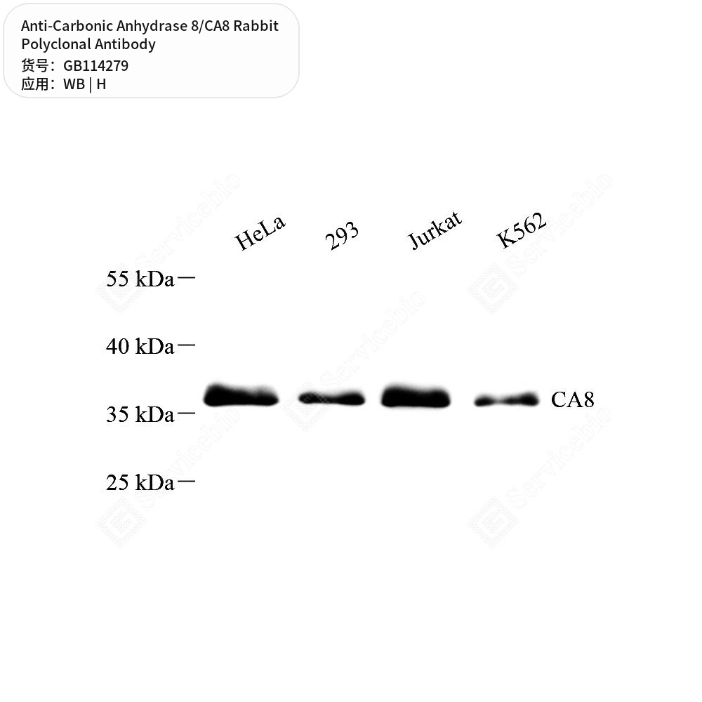 Антитела первичные, поликлональные кролика к Carbonic Anhydrase 8/CA8 человека, 50 мкл