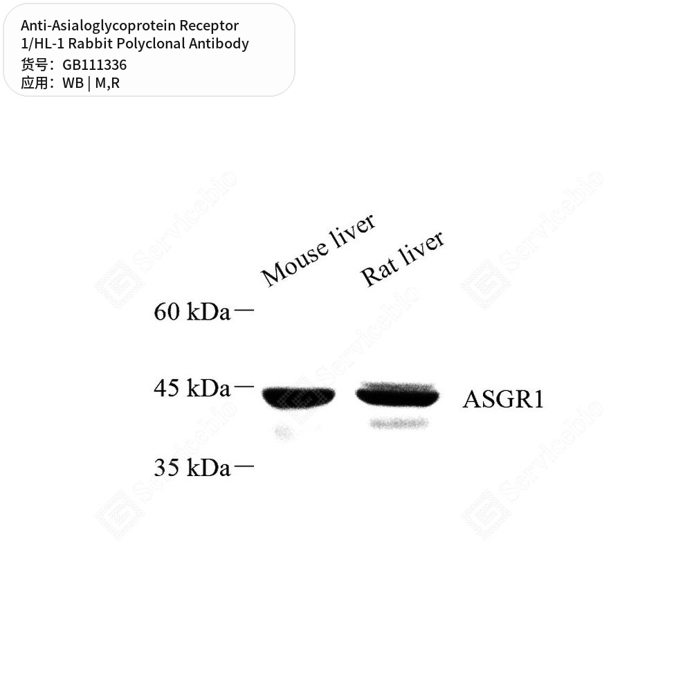Антитела первичные, поликл. кролика к Asialoglycoprotein Receptor 1/HL-1 крысы, мыши, 100 мкл