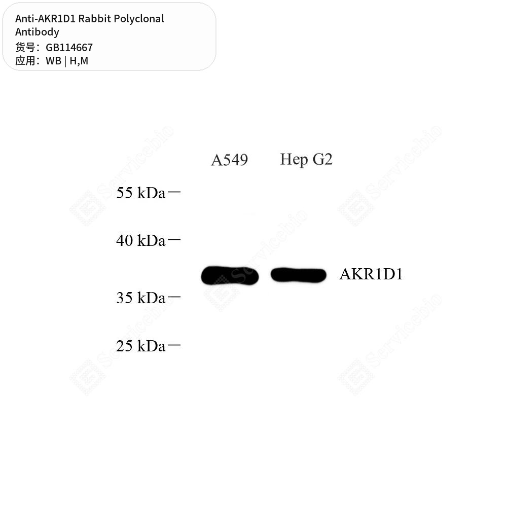 Антитела первичные, поликлональные кролика к AKR1D1 мыши, человека, 50 мкл