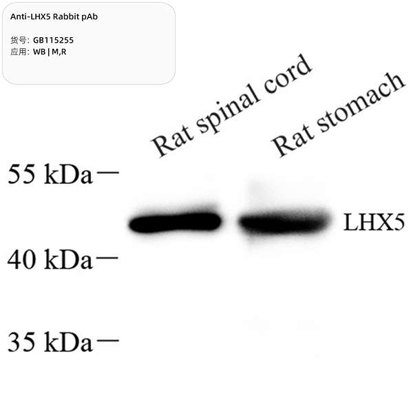 Антитела первичные, поликлональные, LHX5, 100 мкл