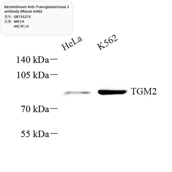 Антитела первичные, моноклональные, TGM2, 100 мкл